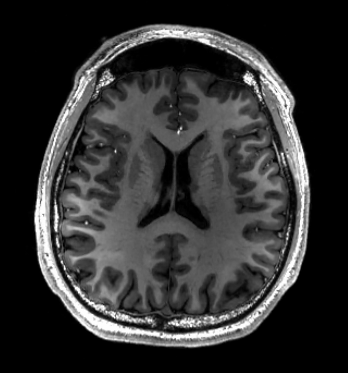 Biomedical AI